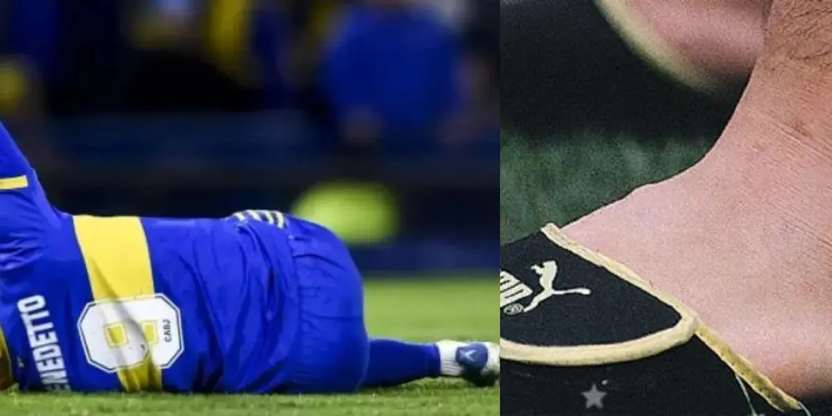 El Pipa se resintió de su lesión en su tobillo izquierdo y vía redes sociales compartió un video para mostrar la situación.